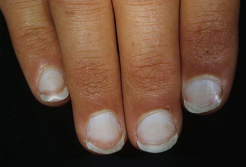 nails1 nails1