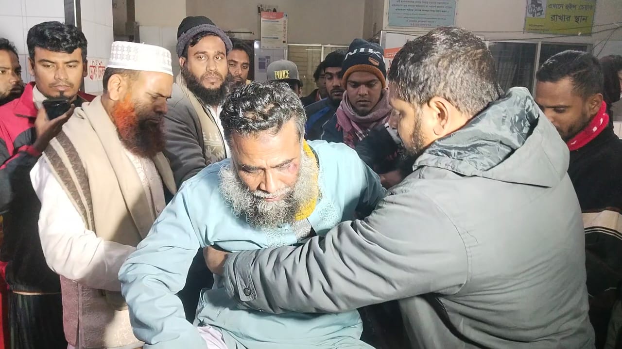 1000198144 1000198144