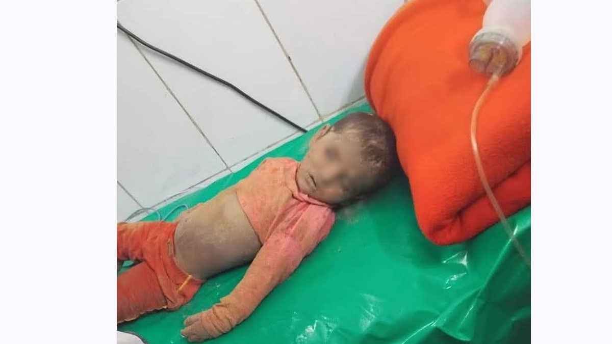 হাসপাতালে শিশু সাজিদ, দেওয়া হচ্ছে অক্সিজেন