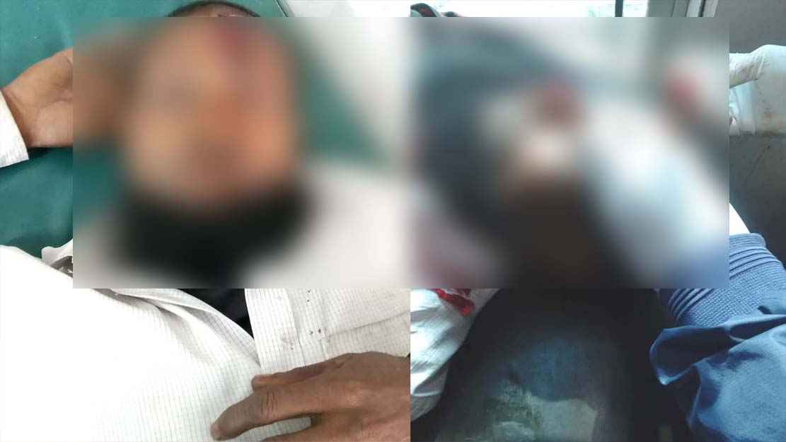 তাড়াশে জমি নিয়ে বিরোধে সংঘর্ষে, আহত ২