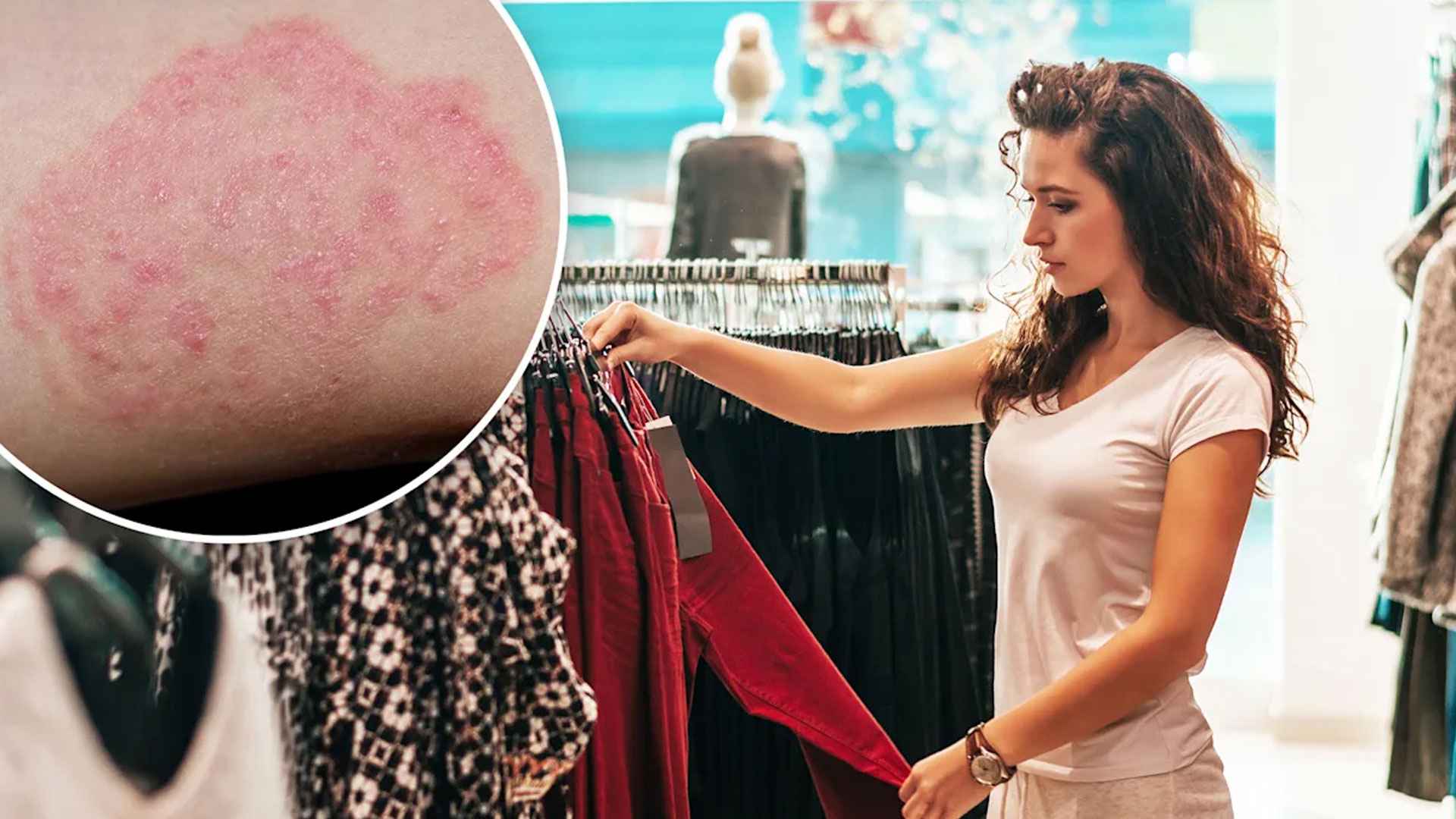 নতুন পোশাক না ধুয়েই পরছেন? ক্ষতি করছেন নিজের!