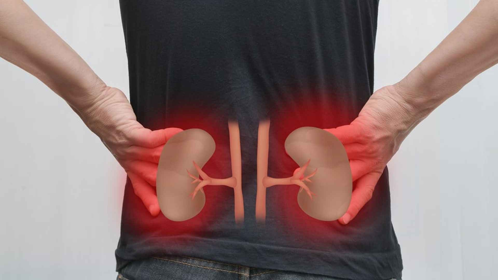 কিডনির ক্ষতি করে পরিচিত এই ৫ খাবার