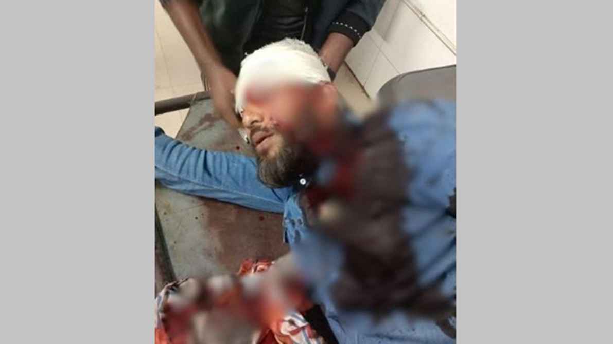 খুলনায় প্রকাশ্যে এনসিপির বিভাগীয় প্রধানকে গুলি, অবস্থা আশঙ্কাজনক