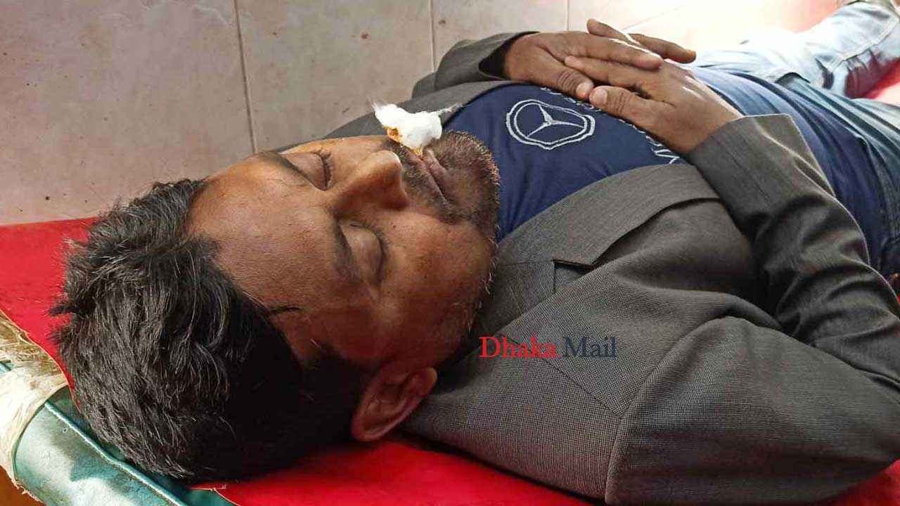 সাংবাদিককে আধাঘণ্টা পিটিয়ে বিএনপি নেতা বললেন ‘মাইর কম হয়ে গেছে’