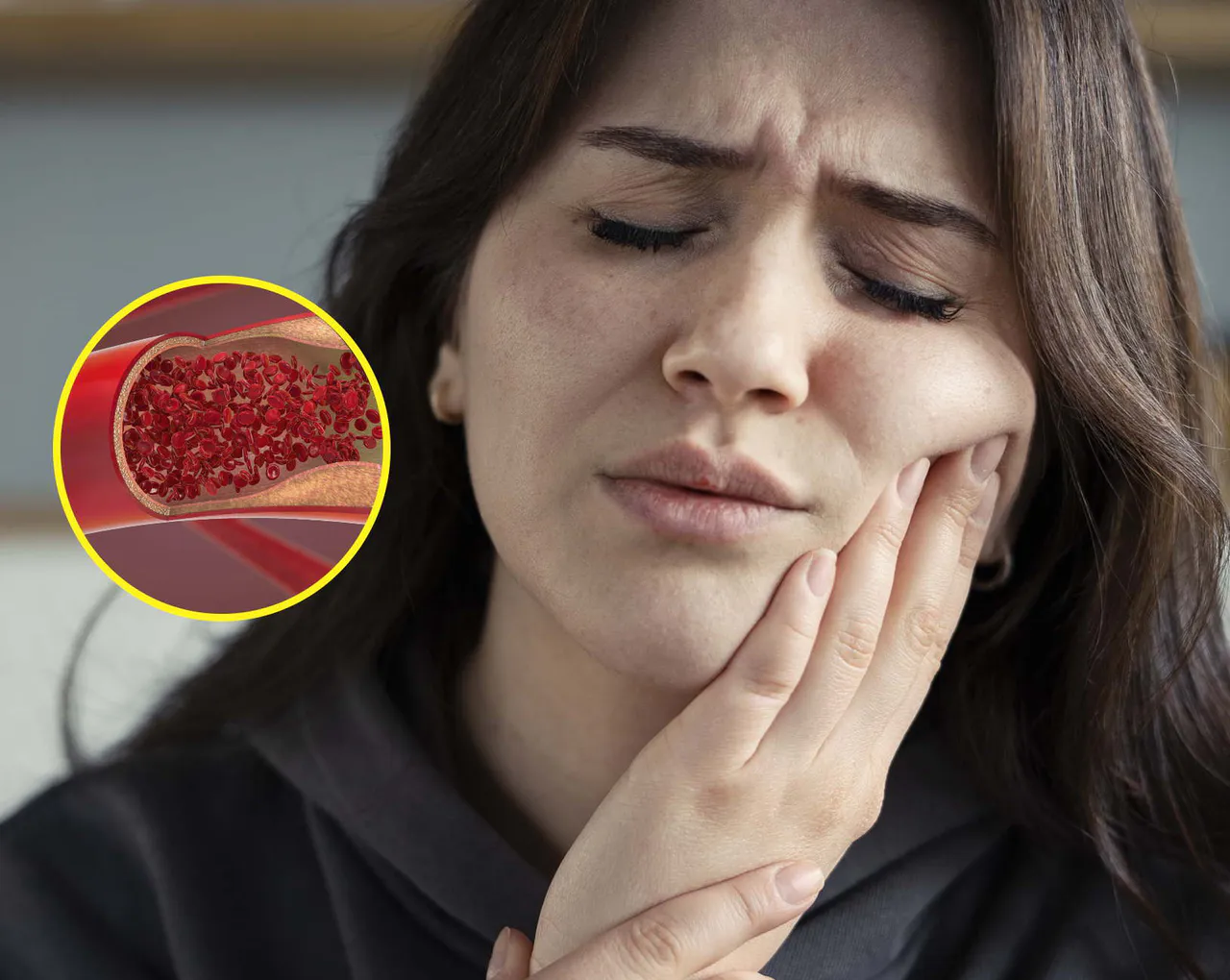 cholesterol3 cholesterol3