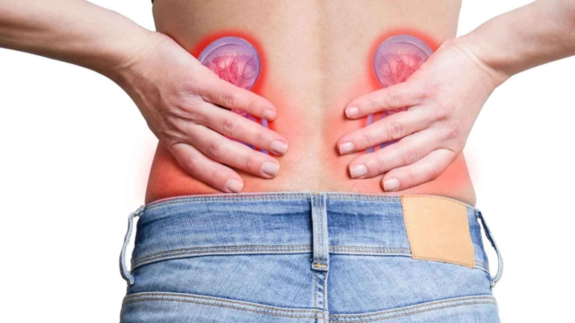 কিডনিতে পাথর হয় এসব খাবার খেলে, অবহেলা করবেন না