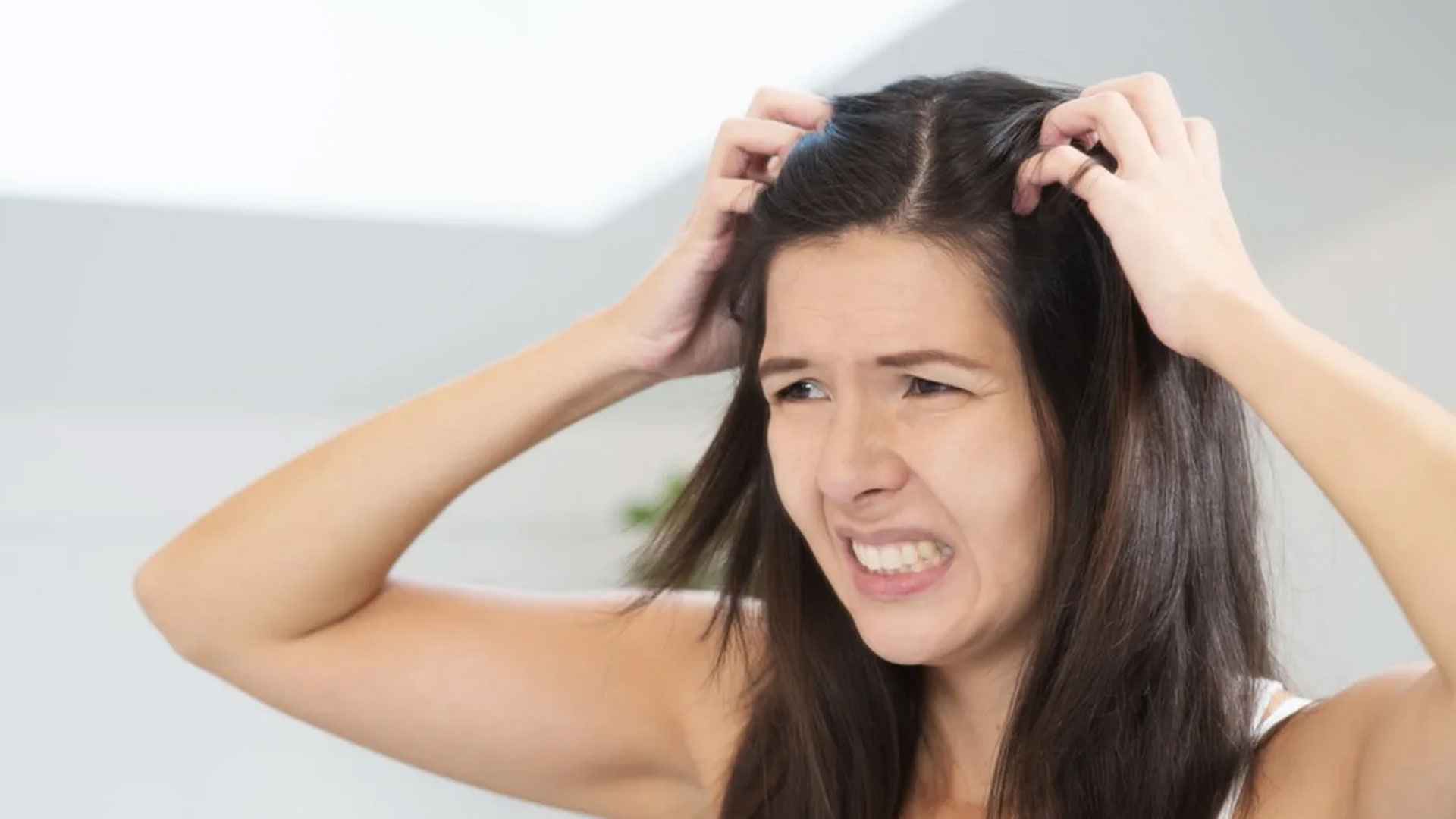 মাথার উকুন দূর করার উপায়