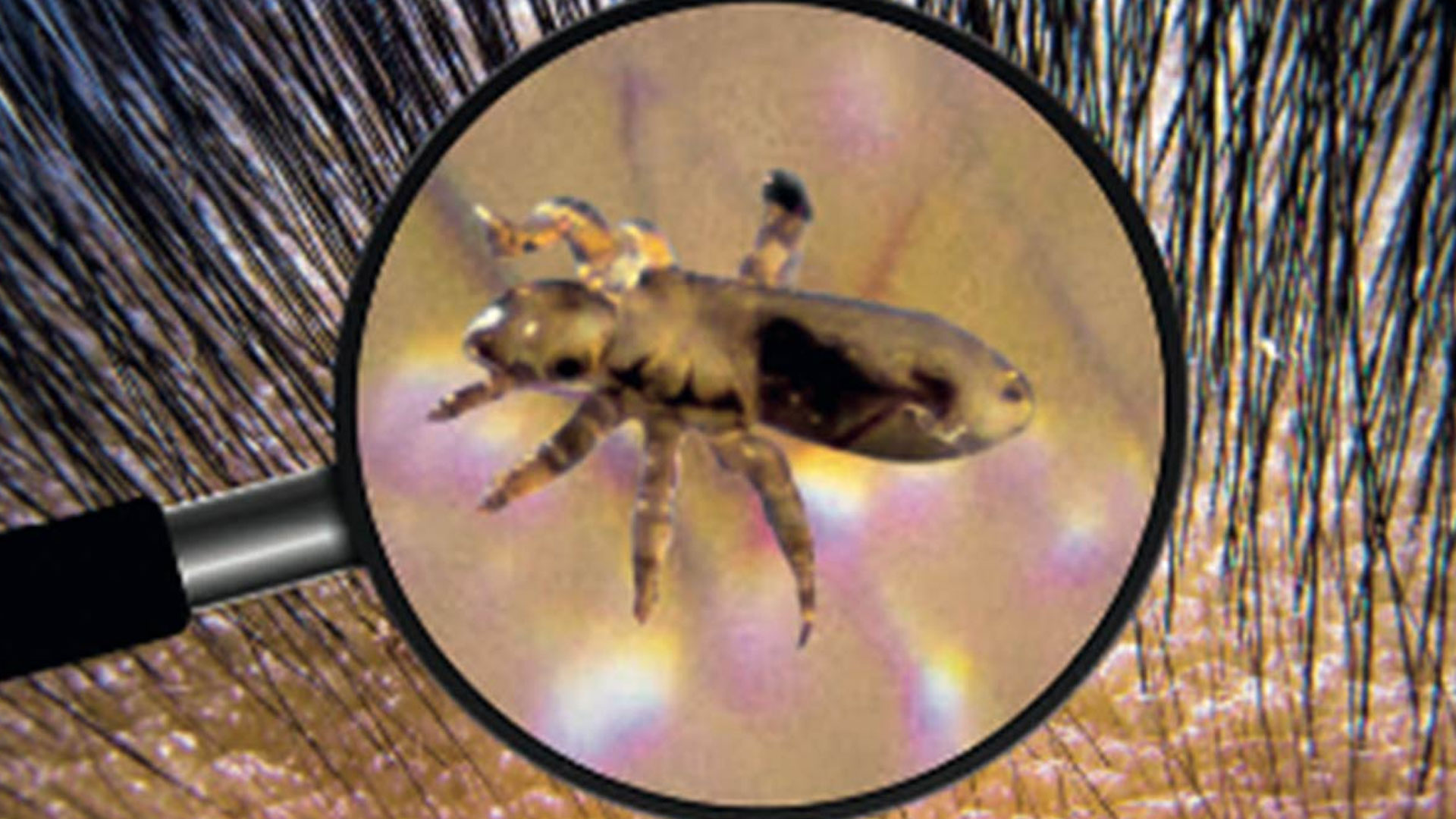 lice2