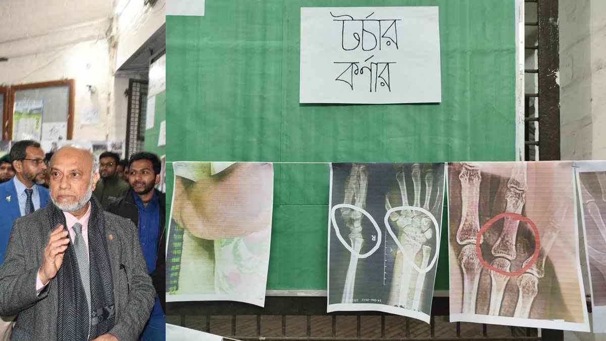 বাকৃবির আশরাফুল হক হলে ‘টর্চার কর্নার’: ভয়াবহ নির্যাতনের ছবি