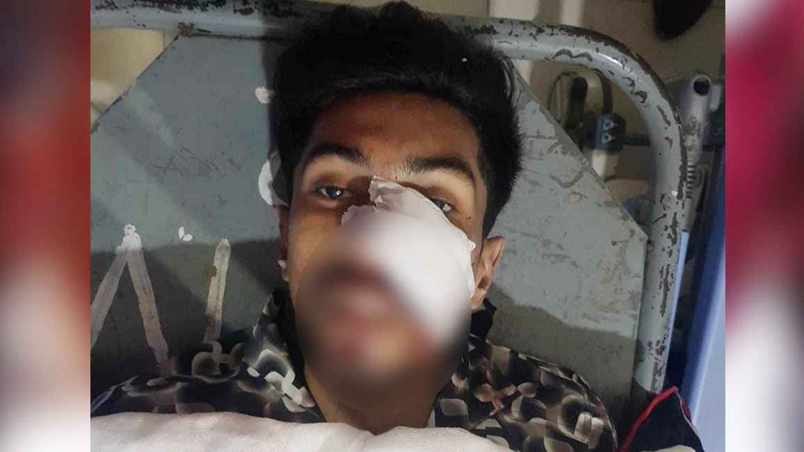 পল্লবীতে সন্ত্রাসী ‘ব্লেড বাবু’কে কুপিয়ে হত্যা