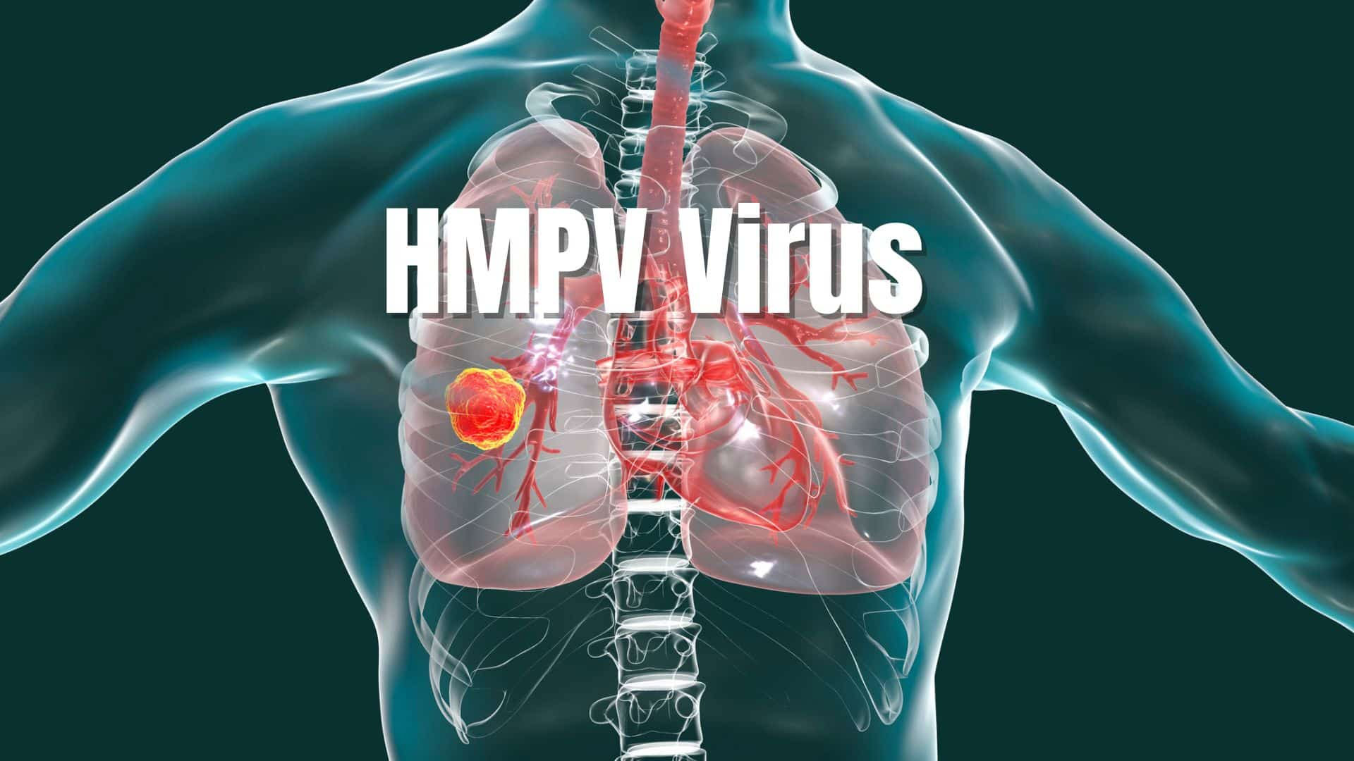 hmpv-virus1 hmpv-virus1