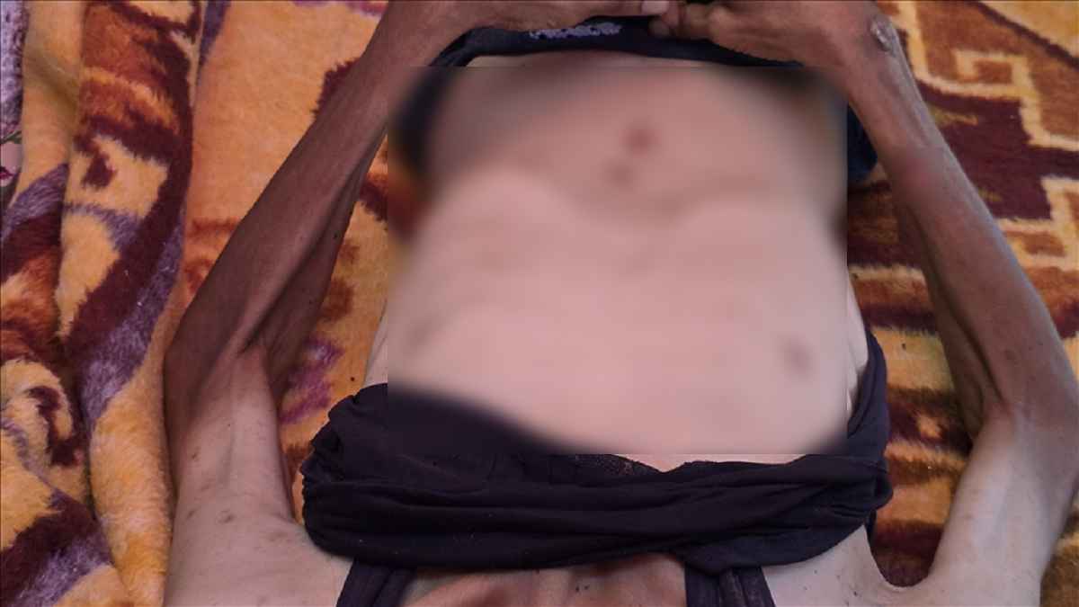গাজায় দুর্ভিক্ষ, ২৪ ঘন্টায় অনাহারে শিশুসহ ১৫ ফিলিস্তিনির মৃত্যু