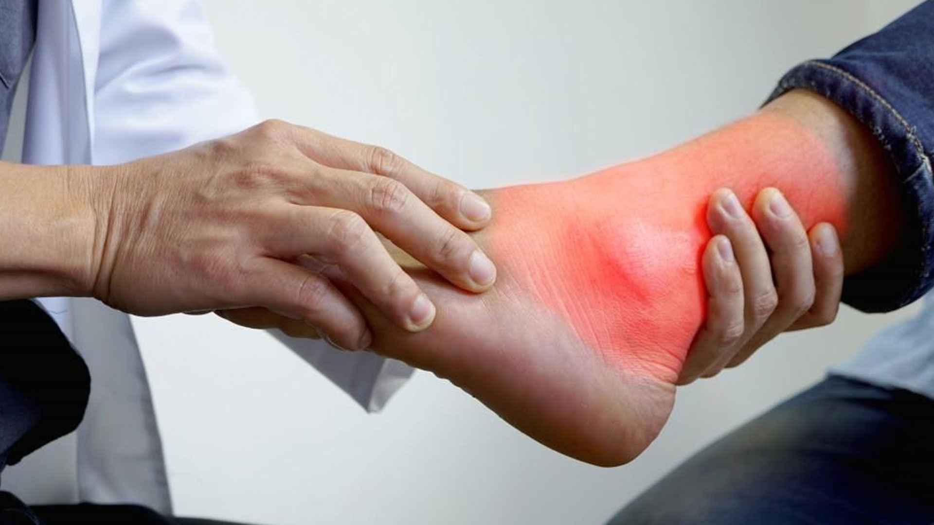 ইউরিক অ্যাসিডের মাত্রা কমায় এই ৪ পানীয়