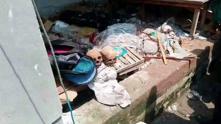পড়ে থাকা ব্যাগ থেকে ৫ মাথার খুলি উদ্ধার, তদন্তে নেমেছে পুলিশ