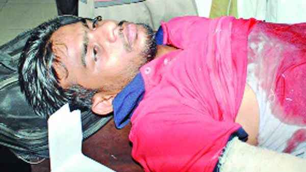 ছাত্রলীগের চাপাতির কোপে বিচ্ছিন্ন শিক্ষার্থীর পা, ১১ বছরেও পাননি বিচার