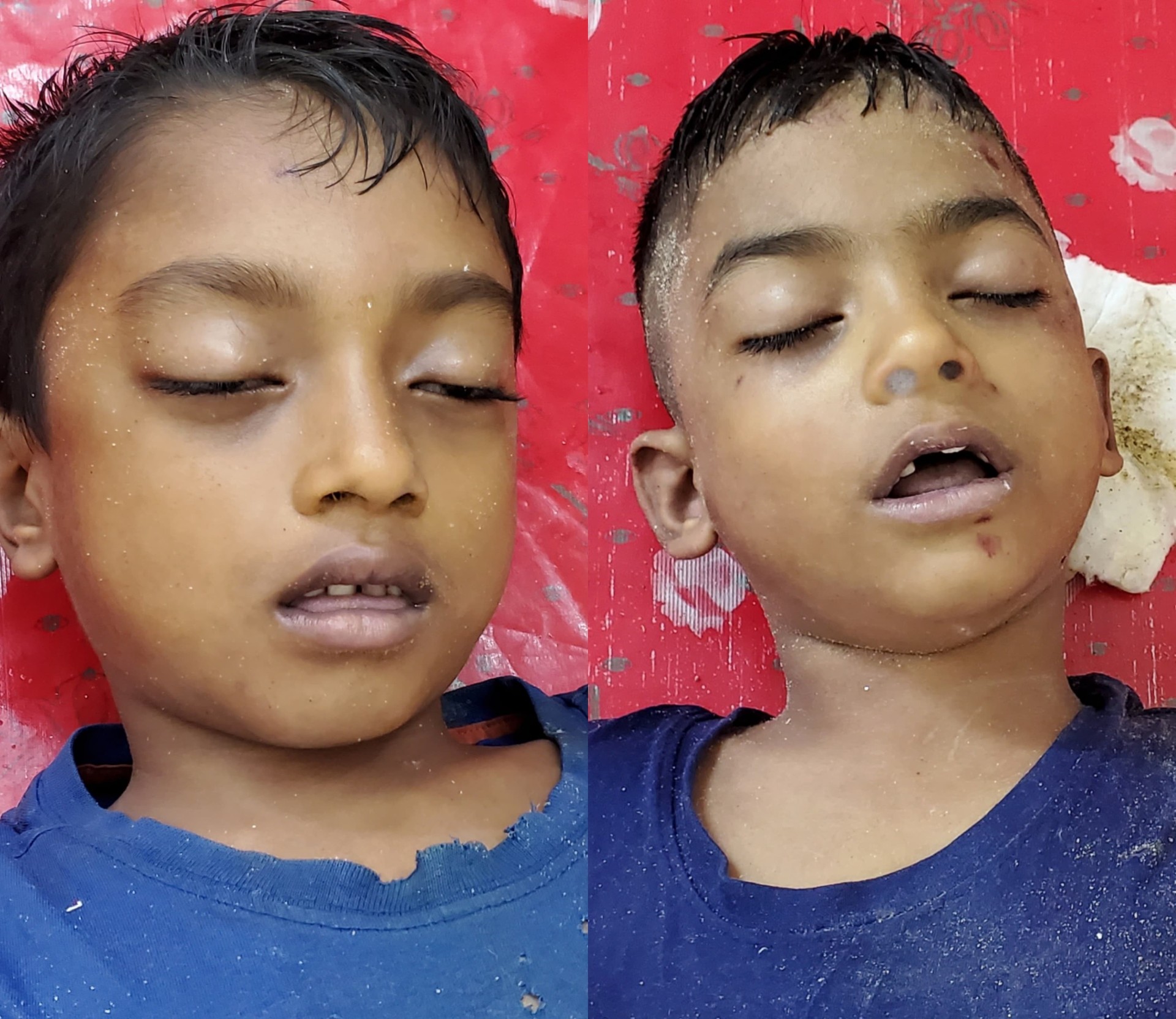 thumbnail_1000433534