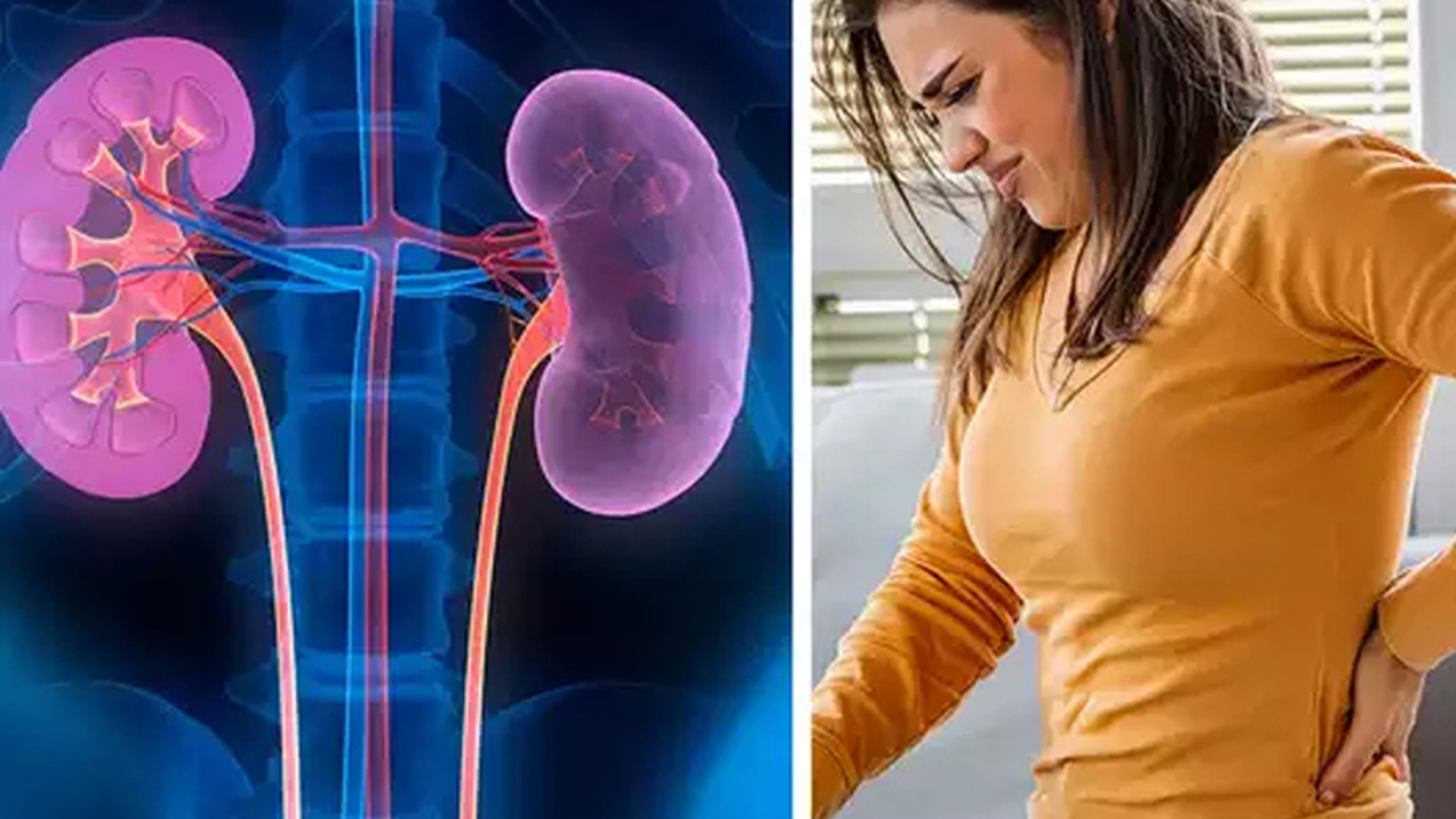 কিডনি২১ কিডনি২১