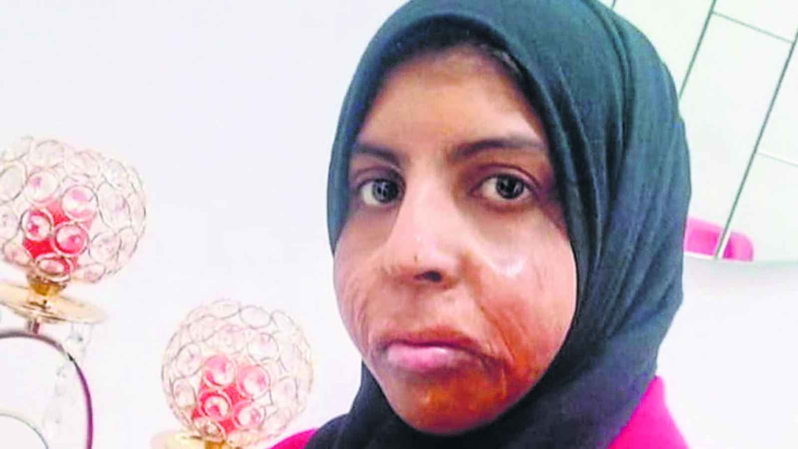 প্লাস্টিক সার্জারি করতে আবুধাবিতে যাওয়া শাহজাদীর ফাঁসি