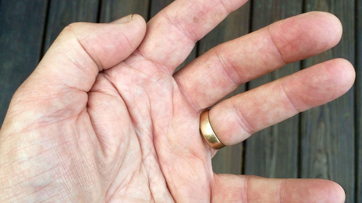 8-metal-ring 8-metal-ring