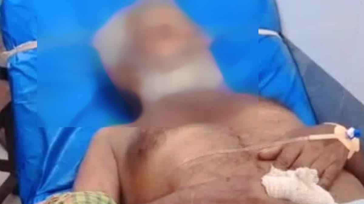 শৈলকুপায় সাপের কামড়ে সাপুরের মৃত্যু