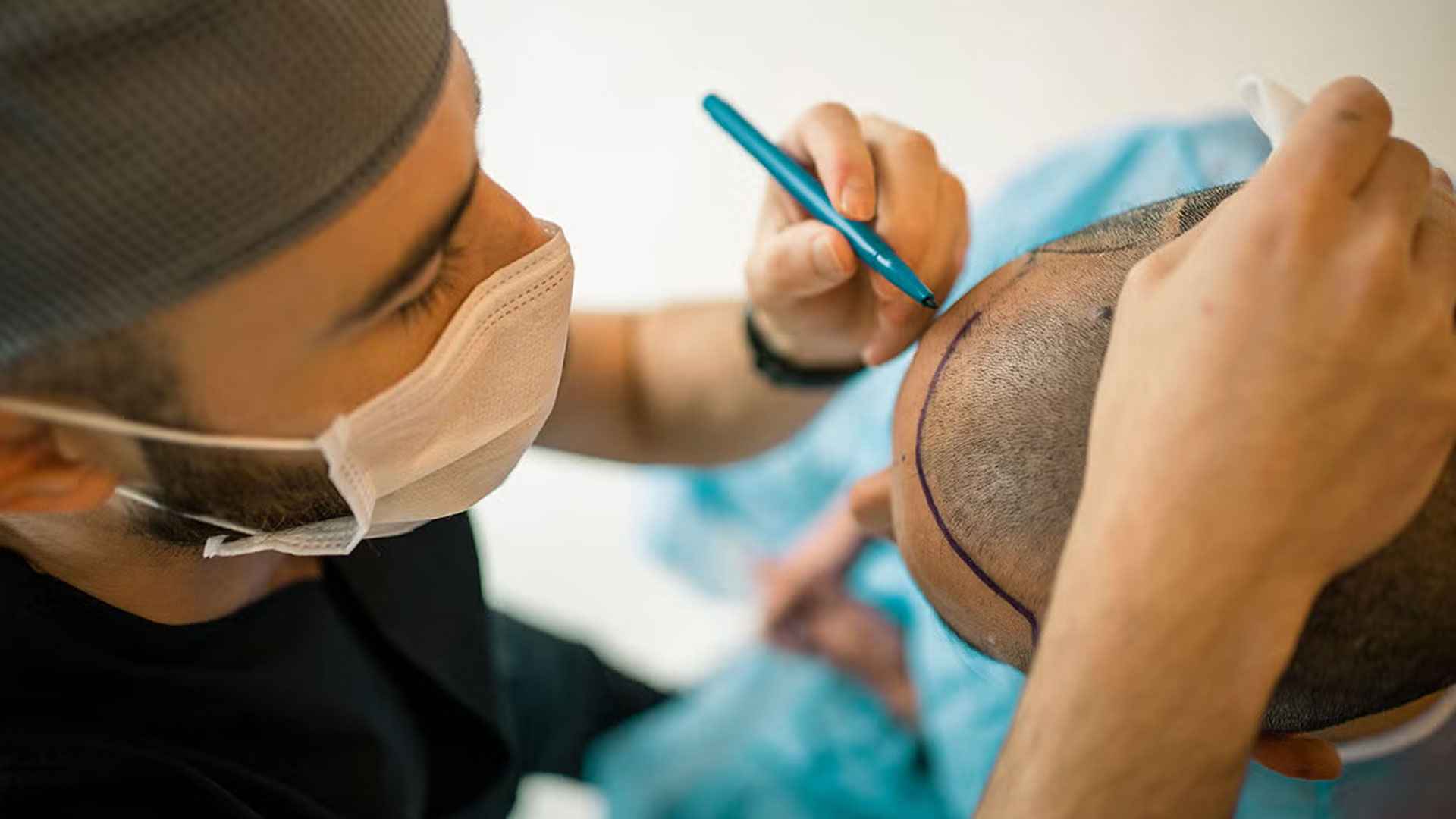 হেয়ার ট্রান্সপ্ল্যান্টের কারণে কি মৃত্যু হতে পারে?