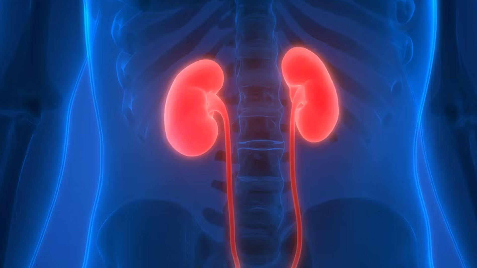 kidney1 kidney1