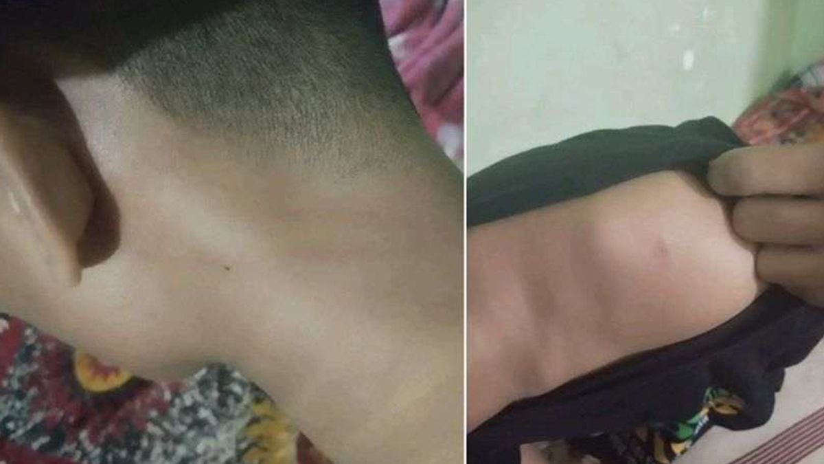 polytechnic1 polytechnic1