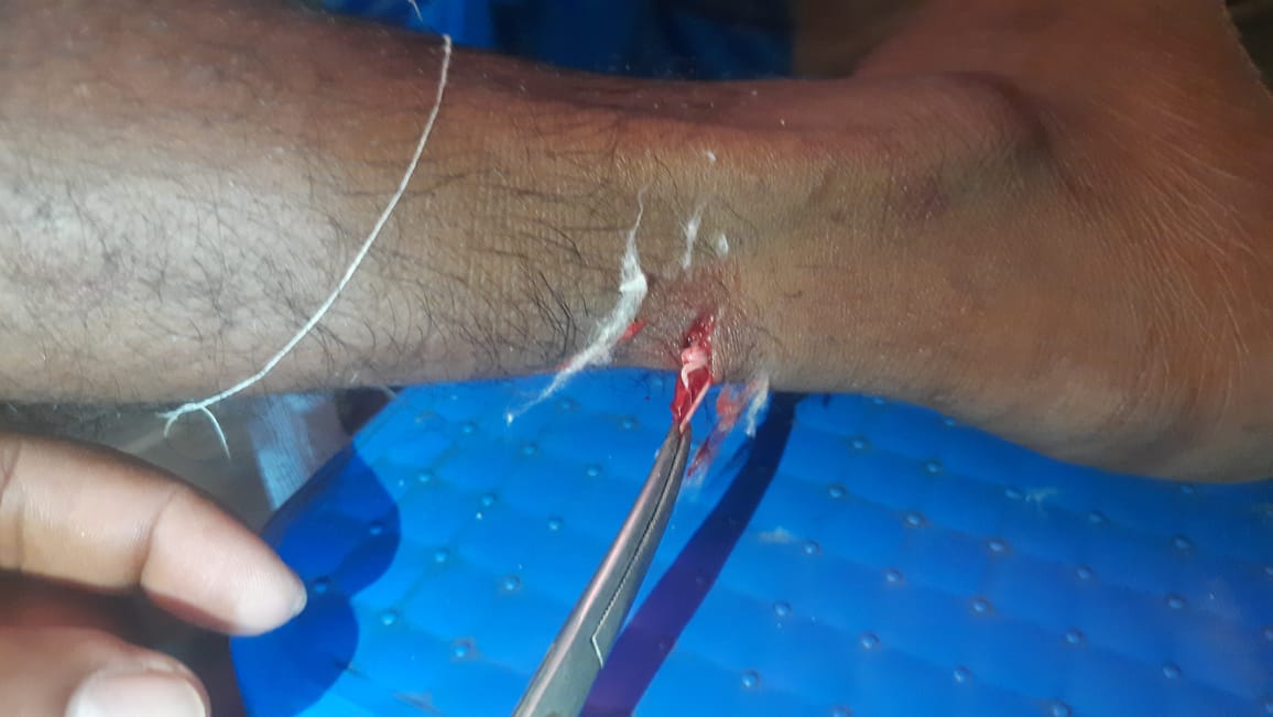 thumbnail_1000024136