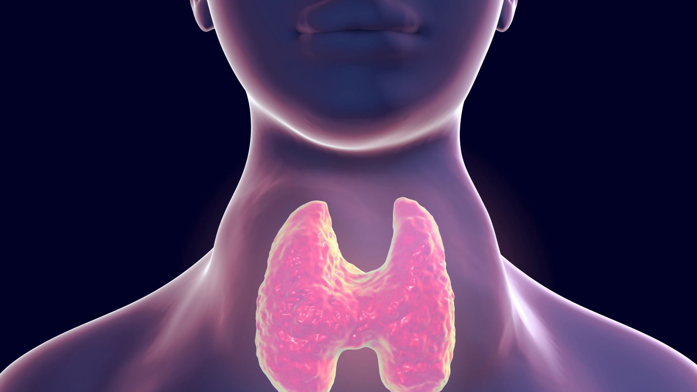thyroid3 thyroid3