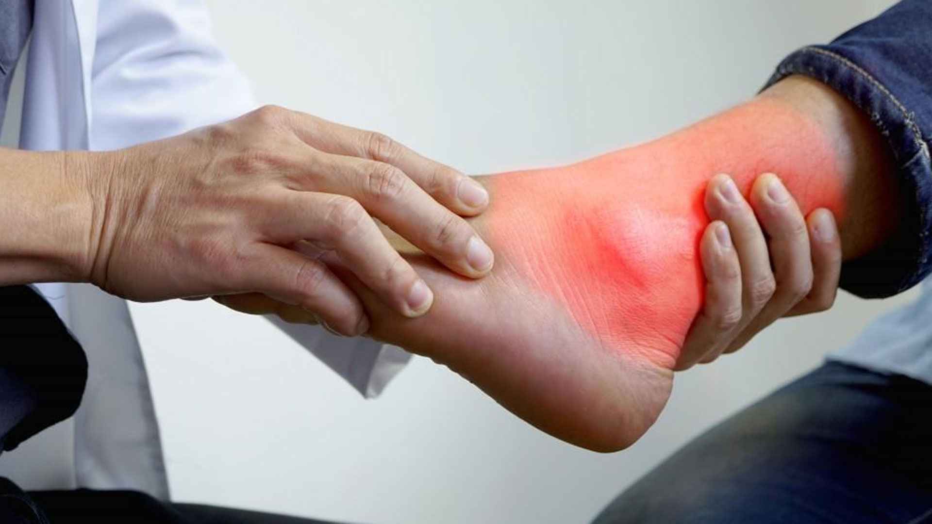 গরমকালে কি ইউরিক অ্যাসিড বাড়তে পারে?