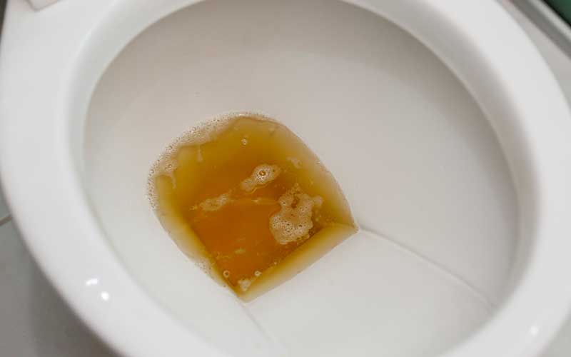 early-warning-signs-of-kidney-failure early-warning-signs-of-kidney-failure