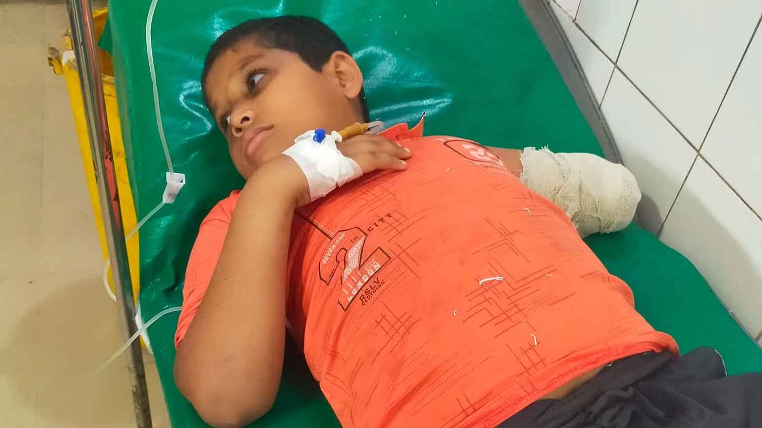 চাঁদপুরে গাড়িচাপায় শিশু রিহানের হাত বিচ্ছিন্ন