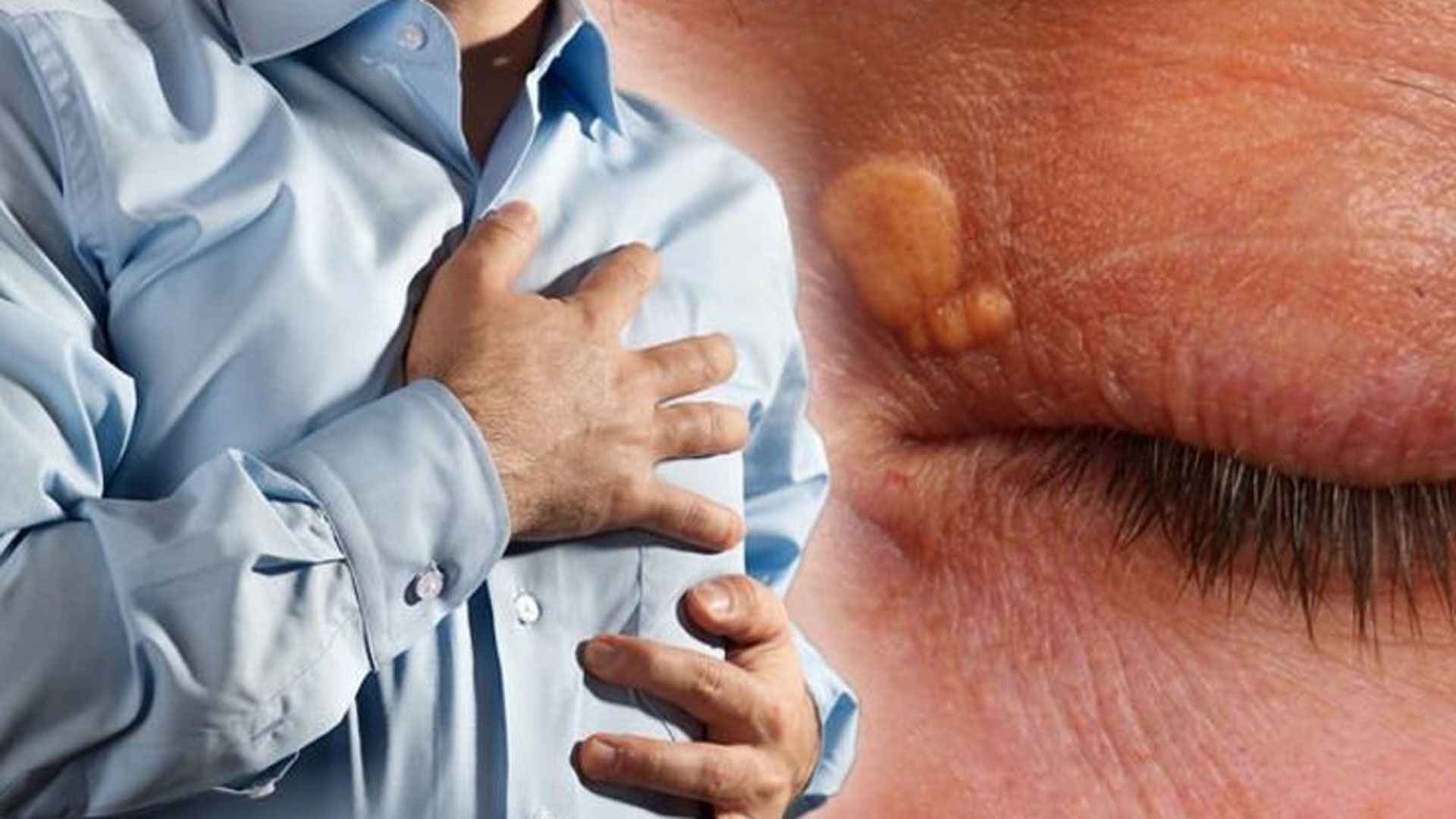 কোলেস্টেরলের মাত্রা কমাতে কোন ধরনের খাবার খাবেন?