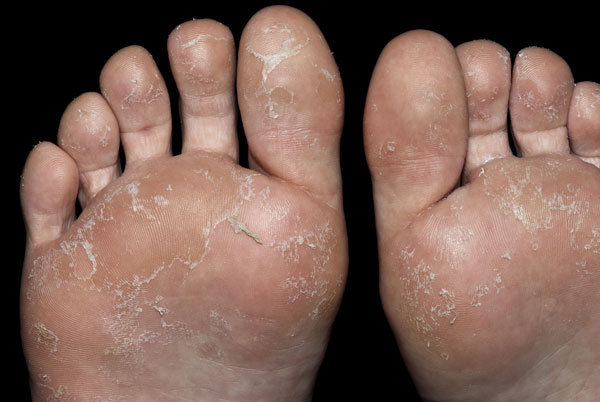 feet feet