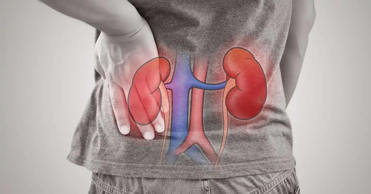 kidney1