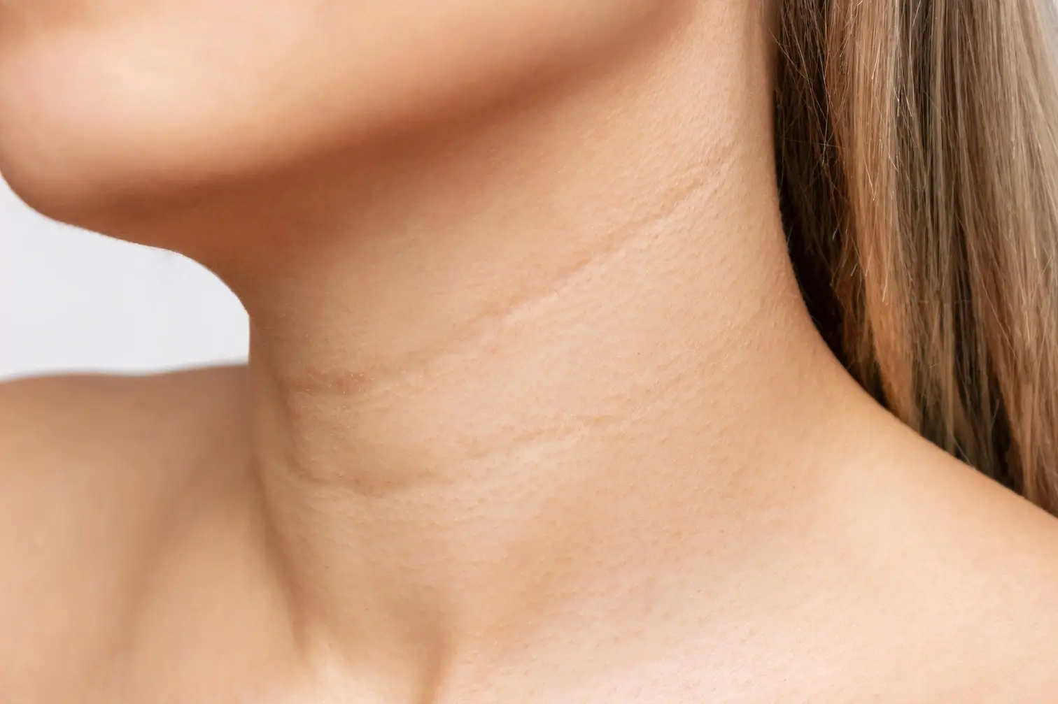 neck_lines3