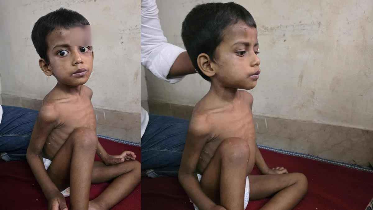 খেতে চাইলেই শিশুকে অমানবিক নির্যাতন করতেন বাবা, তালা ভেঙে উদ্ধার