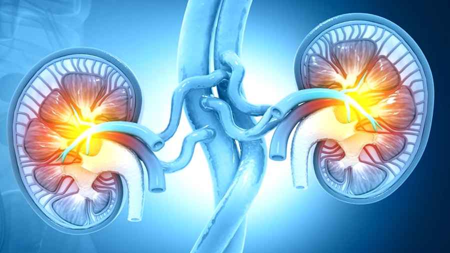 ব্যথার ধরনই বলবে সমস্যা আসলে কিডনিতে!