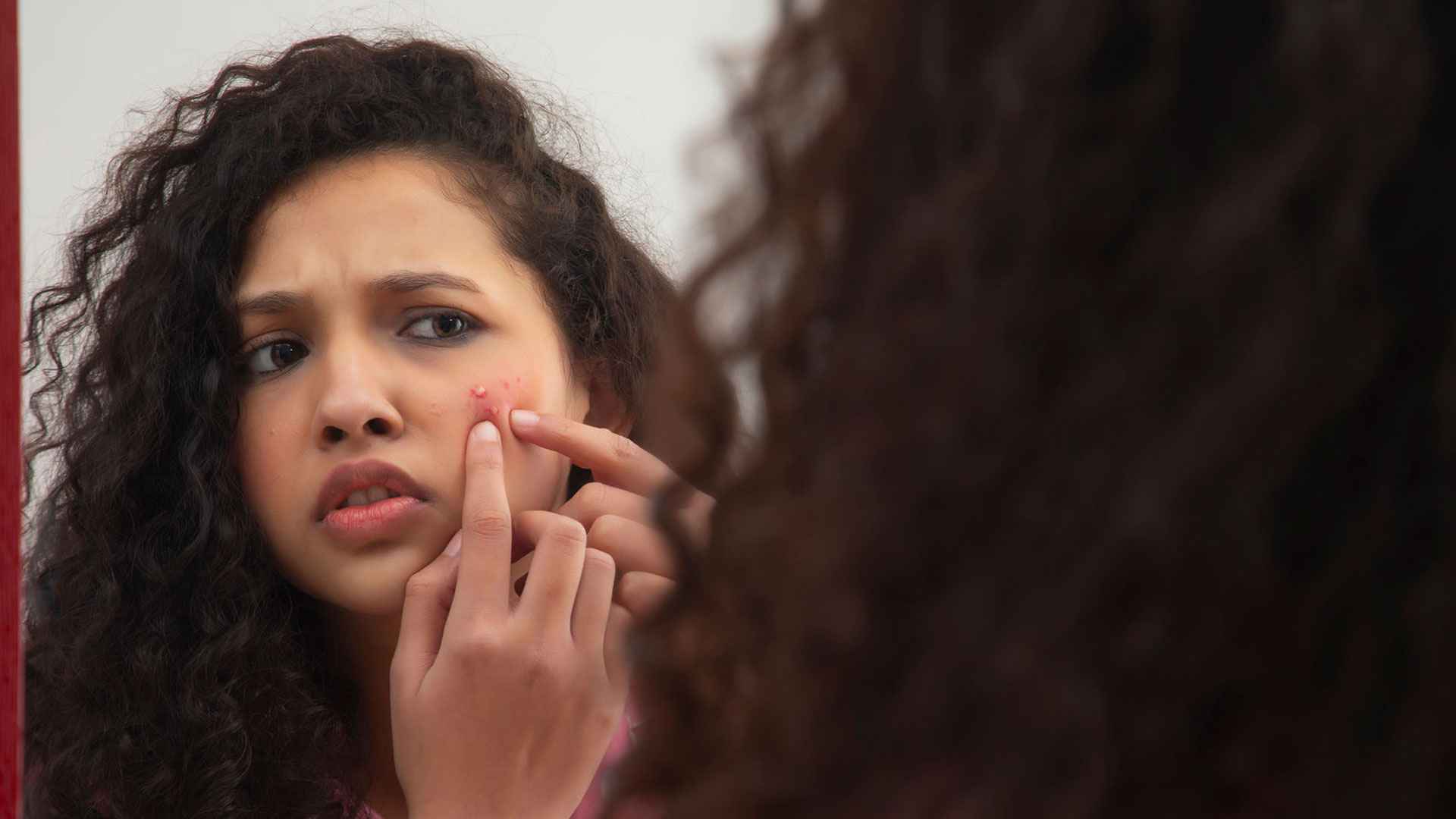 পিরিয়ড ঘনিয়ে এলেই মুখ ব্রণে ভরে যায় কেন? কমাতে করণীয়