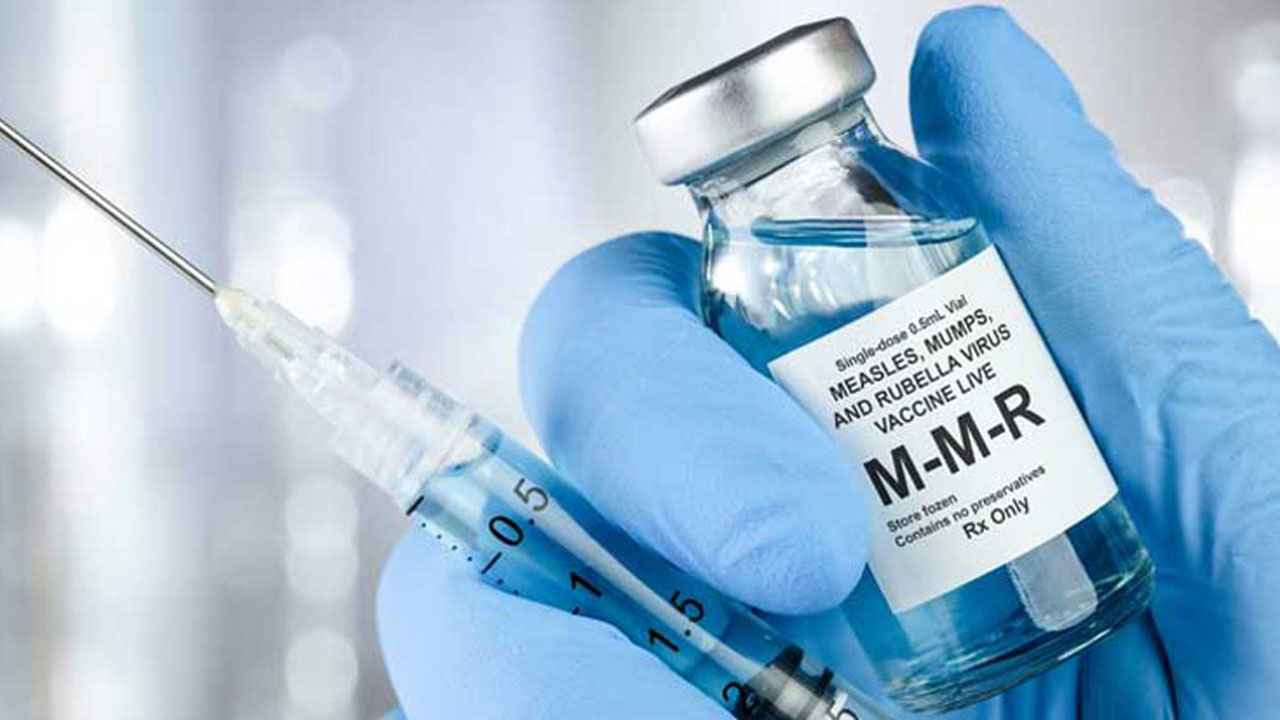 খুলনায় সোমবার থেকে শুরু হবে হামের টিকাদান কার্যক্রম