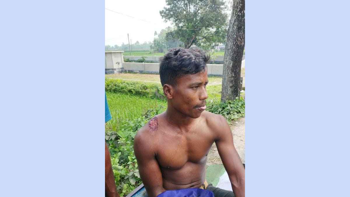 পাটগ্রামে বিএসএফের গুলিতে বাংলাদেশি যুবক আহত, সীমান্তে উত্তেজনা