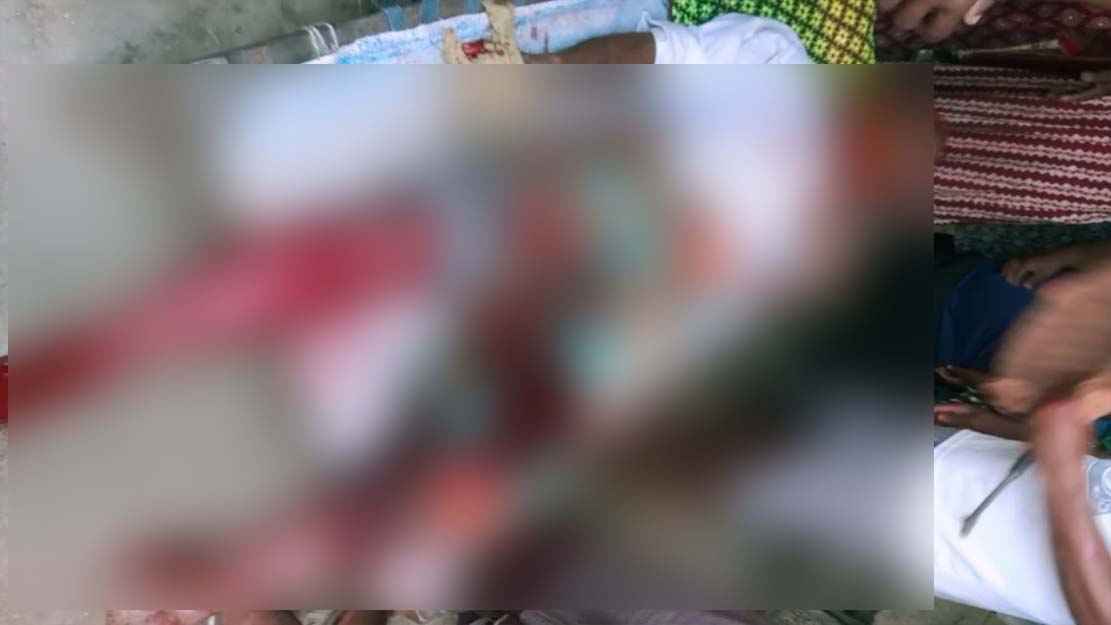 চাঁপাইনবাবগঞ্জে বন্য শূকরের আক্রমণে আহত ৪, একজনের অবস্থা আশঙ্কাজনক