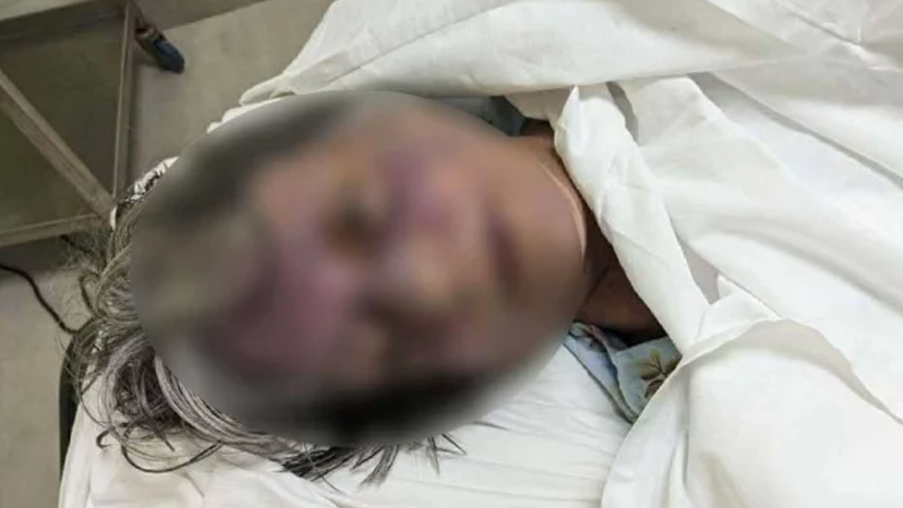 গুলশানে বিদেশি নারীর রহস্যজনক মৃত্যু 