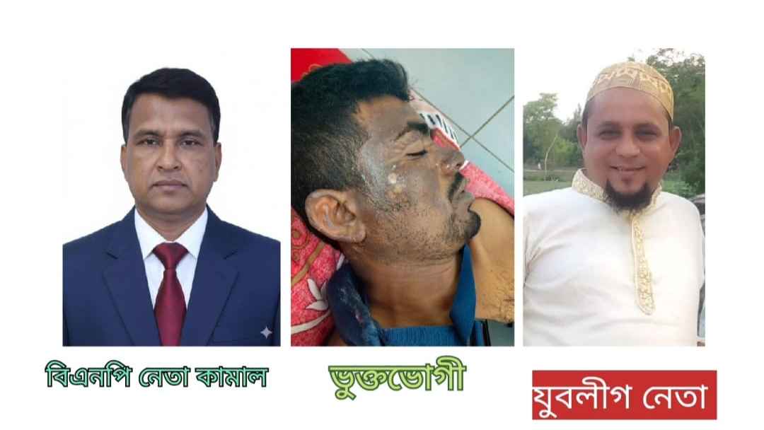 চাঁদা না দেওয়ায় যুবককে অ্যাসিড নিক্ষেপ, বিএনপি নেতাসহ মামলার আসামি ৯
