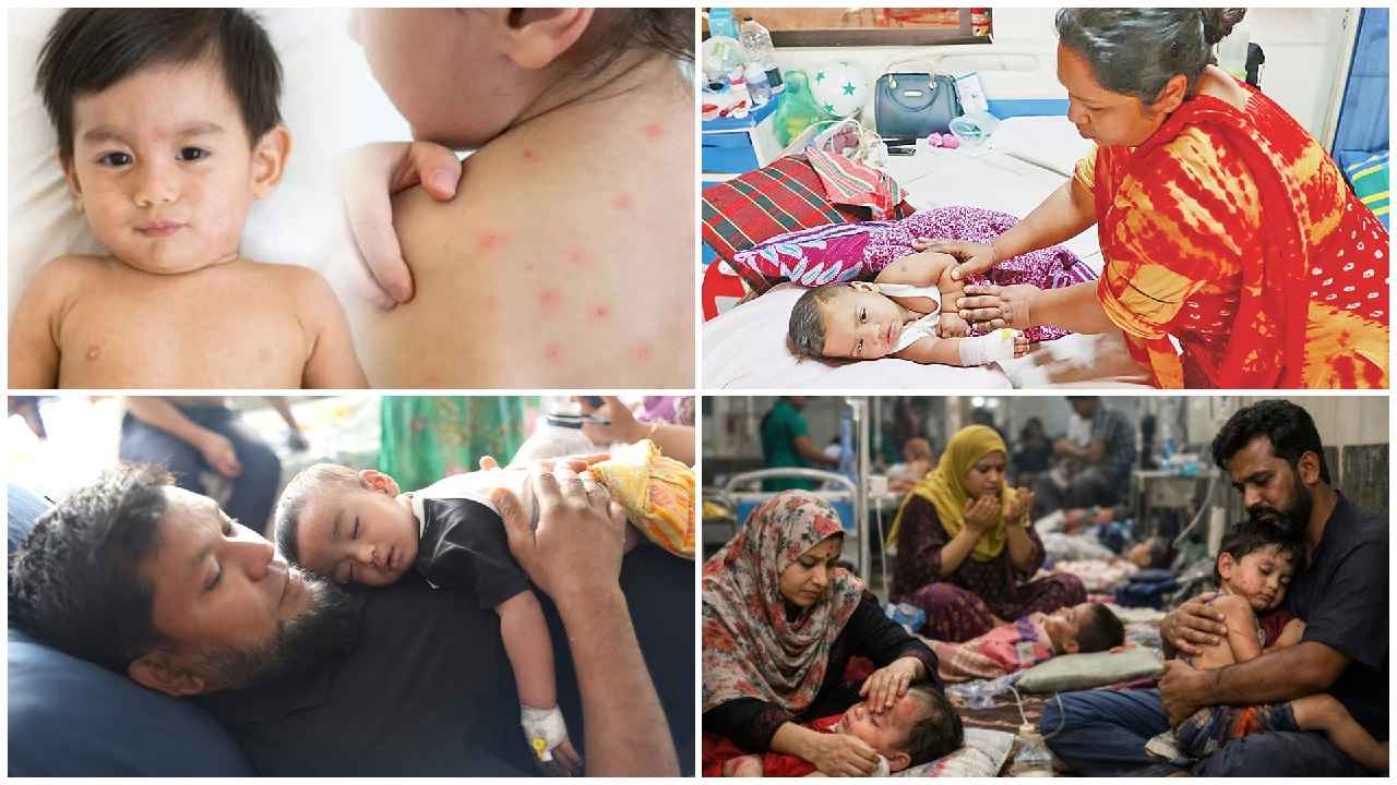 হামের থাবায় নিভছে শিশুপ্রাণ, দিশেহারা বাবা-মা