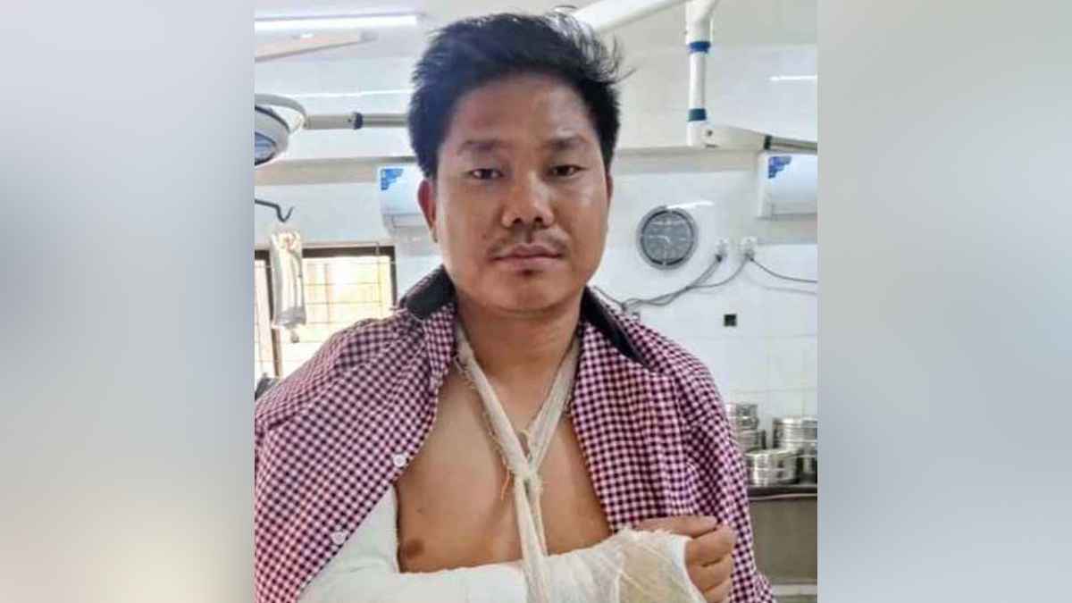 বোতলে অকটেন না পেয়ে ট্যাগ কর্মকর্তার হাত ভেঙে দেওয়ার অভিযোগ