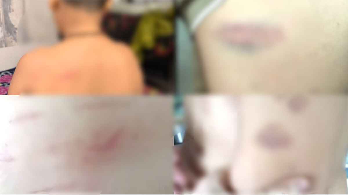 নড়াইলে ছাত্রকে ডাস্টার দিয়ে পেটালেন দুই শিক্ষক