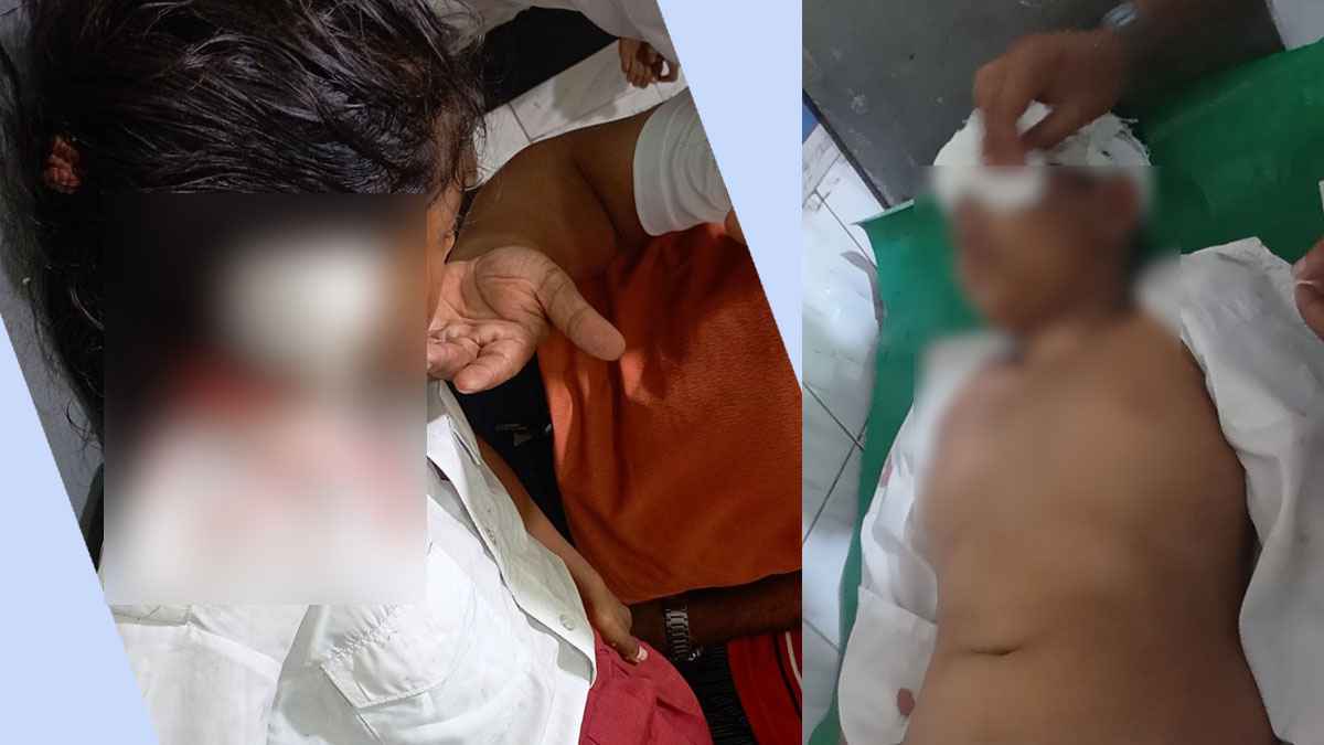 নাজিরপুরে ক্লাস চলাকালীন বৈদ্যুতিক পাখা ছিঁড়ে দুই শিক্ষার্থী আহত