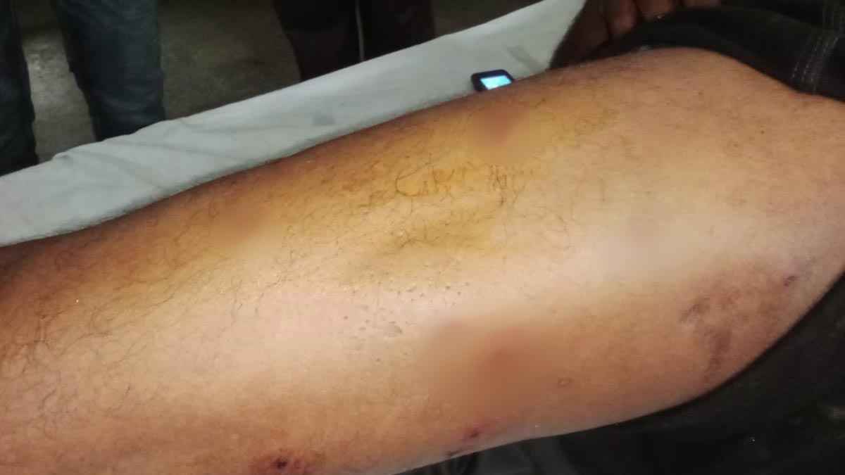 পদ্মা নদীতে টহল পুলিশের ওপর সন্ত্রাসী হামলা, ৫ পুলিশ সদস্য গুলিবিদ্ধ