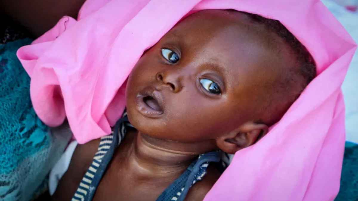 দক্ষিণ সুদানে তীব্র খাদ্যসংকটের শঙ্কা, ৮০ লাখ মানুষ ঝুঁকিতে